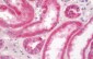SDHA Antibody